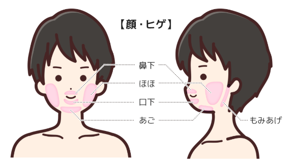 髭脱毛の施術部位の説明図