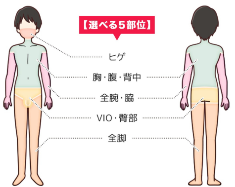 全身脱毛の施術部位の説明図