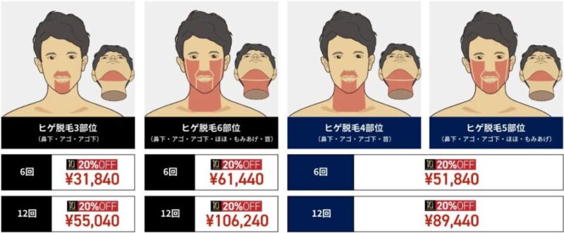 ゴリラクリニックのヒゲ脱毛：20％割引後の価格表