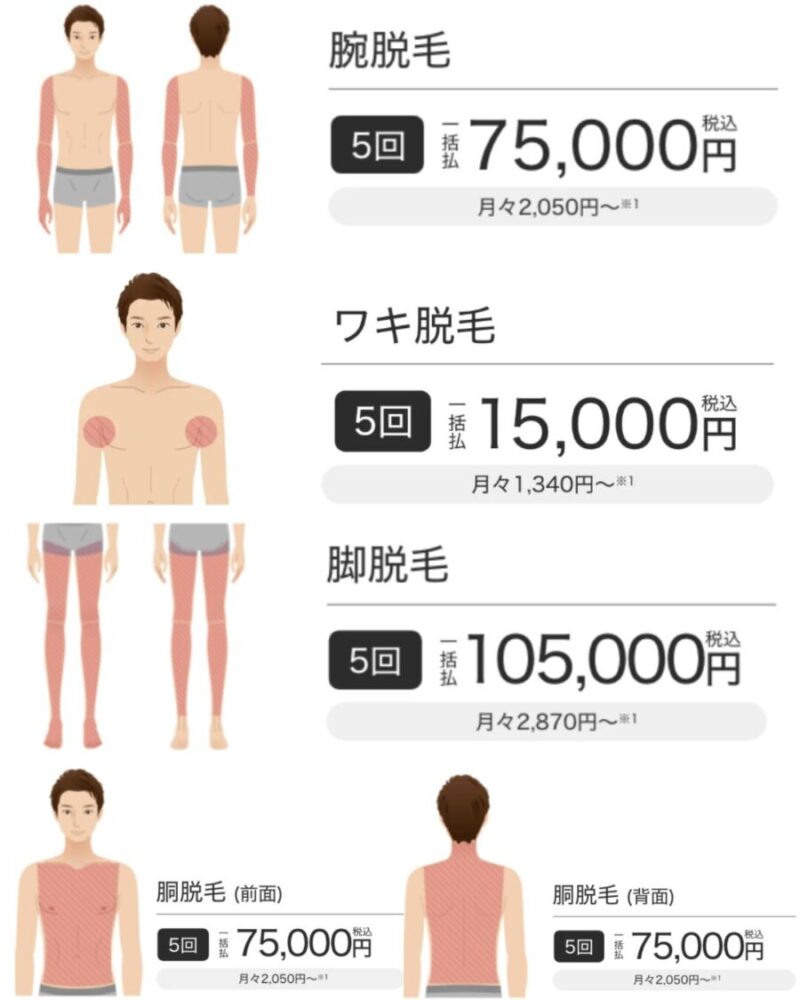 メンズエミナル：身体部位別脱毛の施術部位