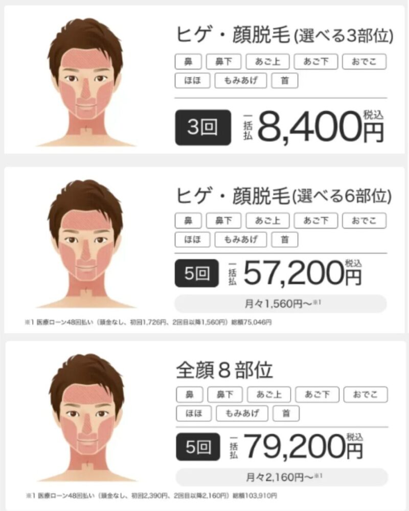 メンズエミナルのライトプラン(ヒゲ脱毛最新価格)