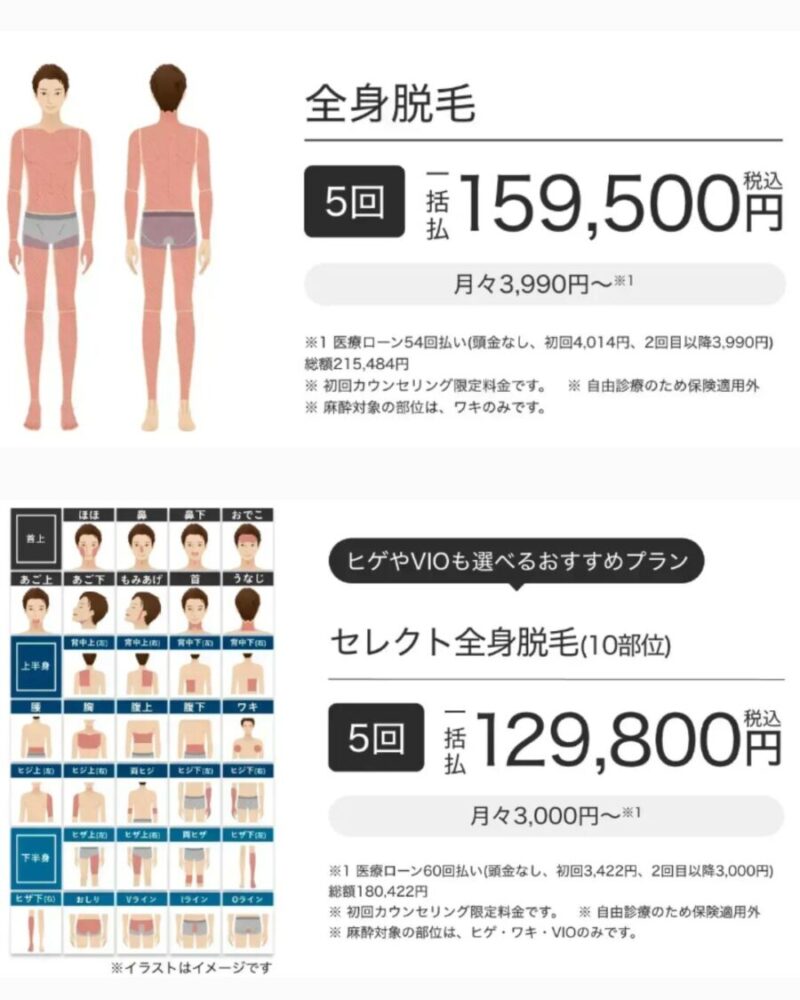 メンズエミナルのライトプラン(全身脱毛最新価格)