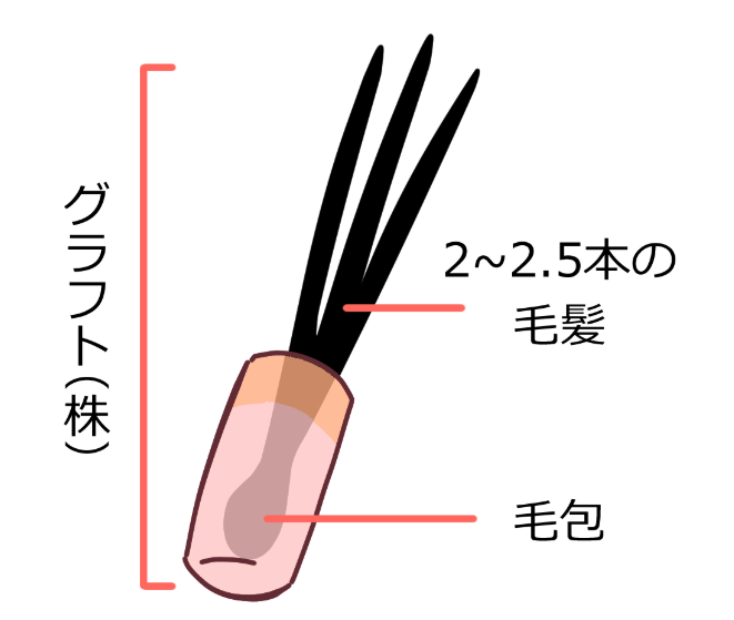 グラフト株のイメージ図