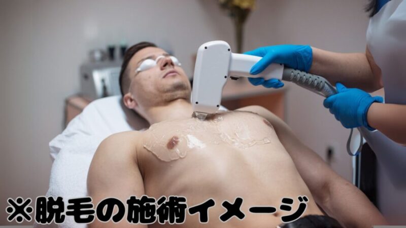 胸毛脱毛の施術イメージ
