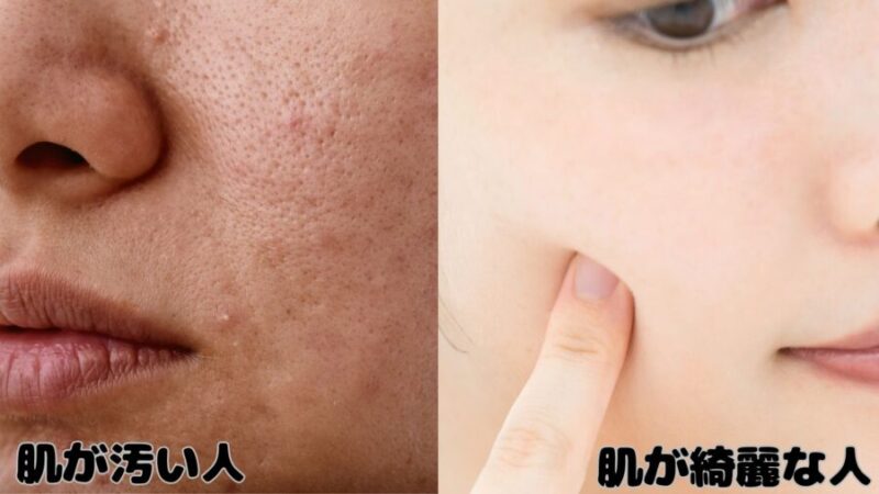 肌が綺麗な人と肌が汚い人の違い