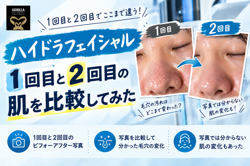 ハイドラフェイシャル肌比較ビフォーアフター