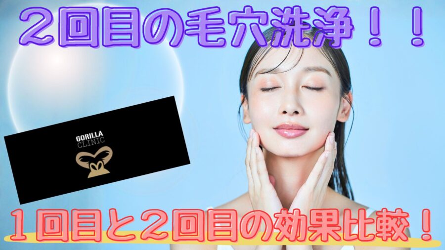 ゴリラクリニックで2回目のハイドラフェイシャル